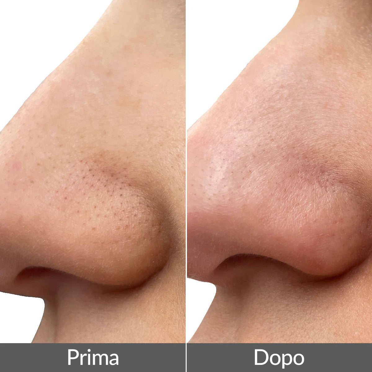 PMD Wave Pro + IN REGALO Recovery Anti-Aging Collagen  Mask