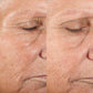 Personal Microderm Elite Pro